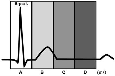 Effects of interoceptive accuracy on timing control in the synchronization tapping task